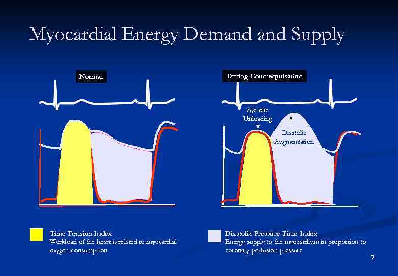 Myocardial Energy Demand Supply Normal During Counterpulsation Systolic Unloading Diastolic Augmentation Time Tension Index