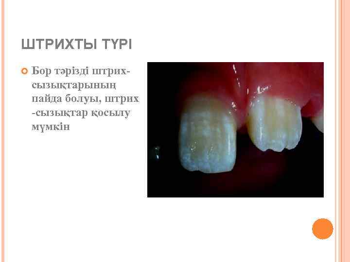 ШТРИХТЫ ТҮРІ Бор тәрізді штрихсызықтарының пайда болуы, штрих -сызықтар қосылу мүмкін 