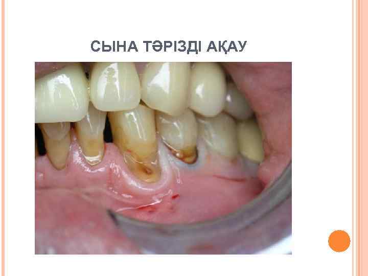 СЫНА ТӘРІЗДІ АҚАУ 