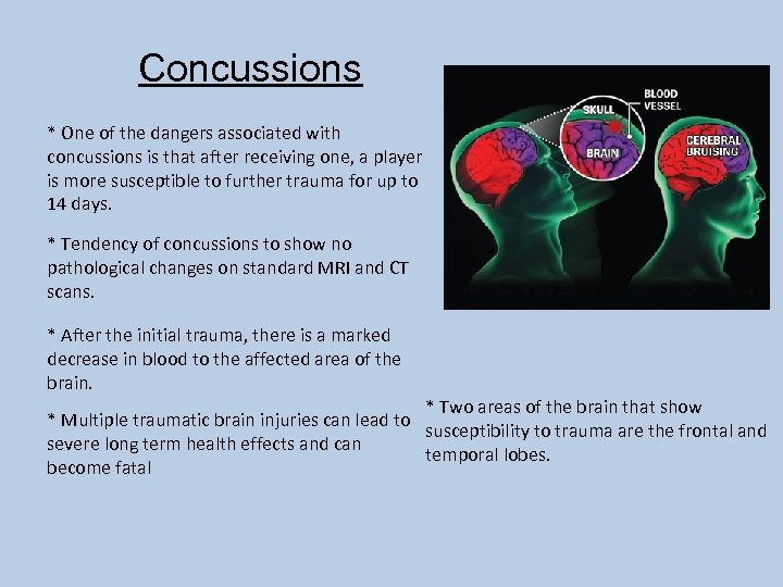 Concussions * One of the dangers associated with concussions is that after receiving one,