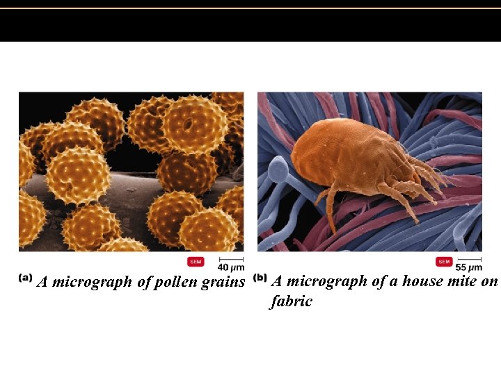 Figure 19. 2 Localized anaphylaxis. A micrograph of pollen grains A micrograph of a