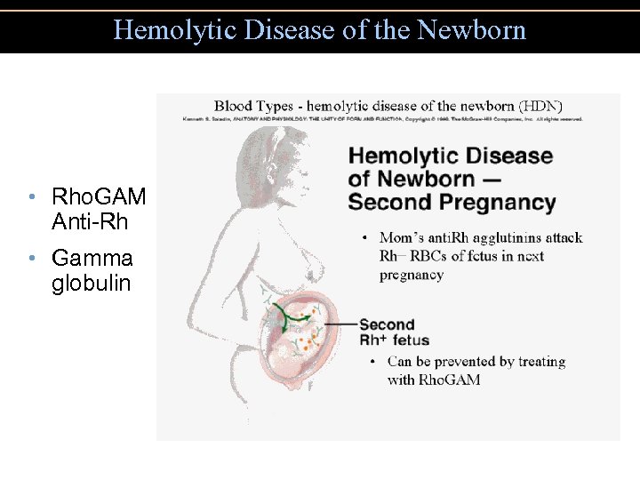 Hemolytic Disease of the Newborn • Rho. GAM Anti-Rh • Gamma globulin 