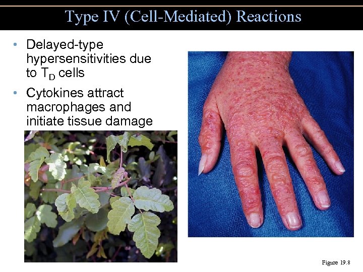 Type IV (Cell-Mediated) Reactions • Delayed-type hypersensitivities due to TD cells • Cytokines attract