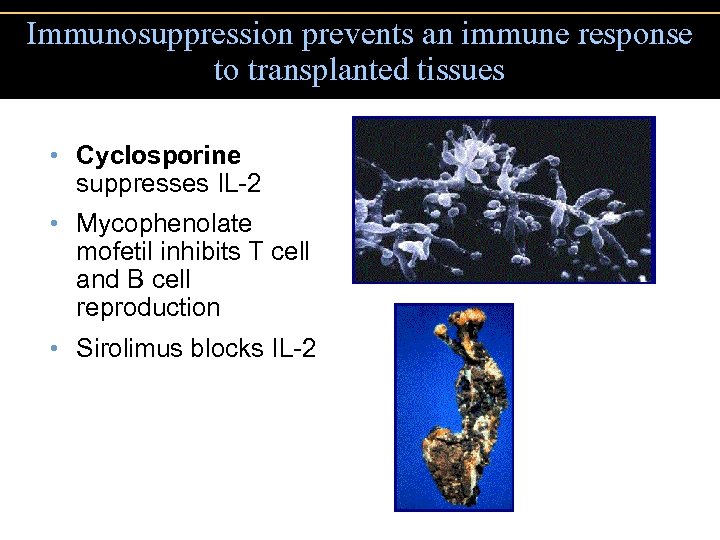 Immunosuppression prevents an immune response to transplanted tissues • Cyclosporine suppresses IL-2 • Mycophenolate