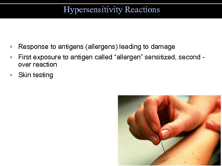 Hypersensitivity Reactions • Response to antigens (allergens) leading to damage • First exposure to