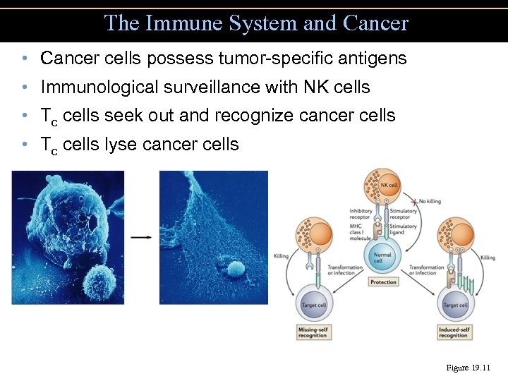 The Immune System and Cancer • Cancer cells possess tumor-specific antigens • Immunological surveillance