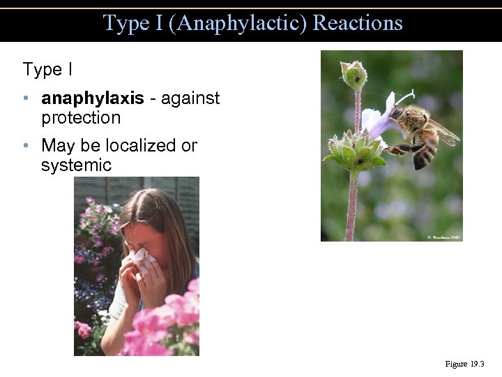 Type I (Anaphylactic) Reactions Type I • anaphylaxis - against protection • May be