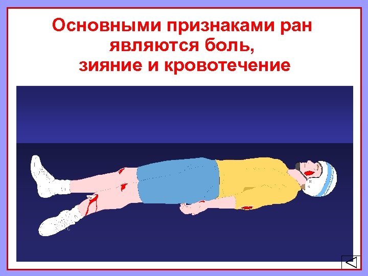 Основными признаками ран являются боль, зияние и кровотечение 