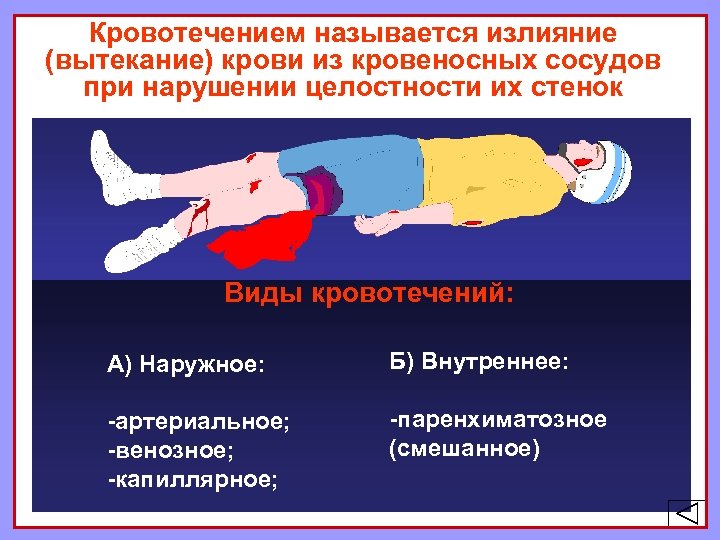 Кровотечением называется излияние (вытекание) крови из кровеносных сосудов при нарушении целостности их стенок Виды