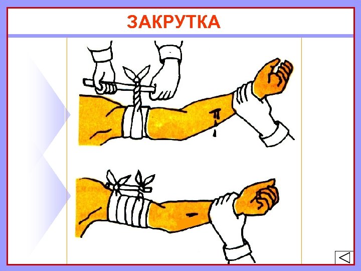 ЗАКРУТКА 