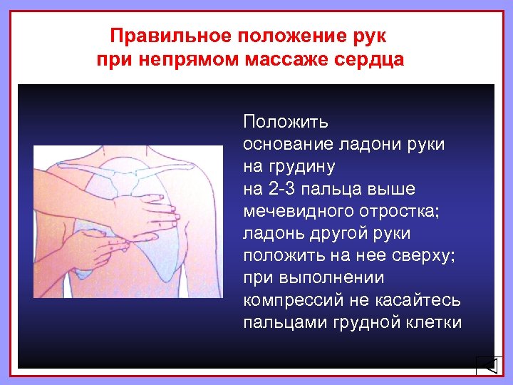 Правильное положение рук при непрямом массаже сердца Положить основание ладони руки на грудину на