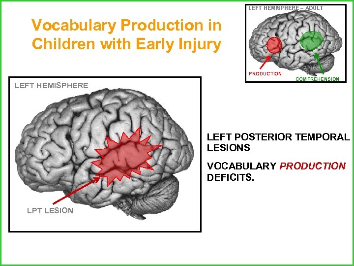 LEFT HEMISPHERE – ADULT Vocabulary Production in Children with Early Injury PRODUCTION LEFT HEMISPHERE