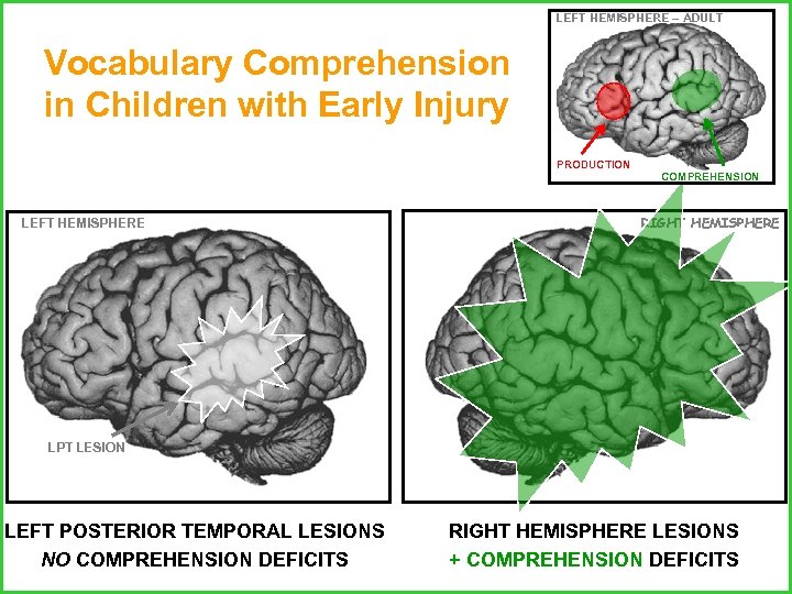 LEFT HEMISPHERE – ADULT Vocabulary Comprehension in Children with Early Injury PRODUCTION LEFT HEMISPHERE