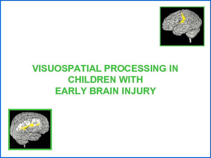 VISUOSPATIAL PROCESSING IN CHILDREN WITH EARLY BRAIN INJURY 