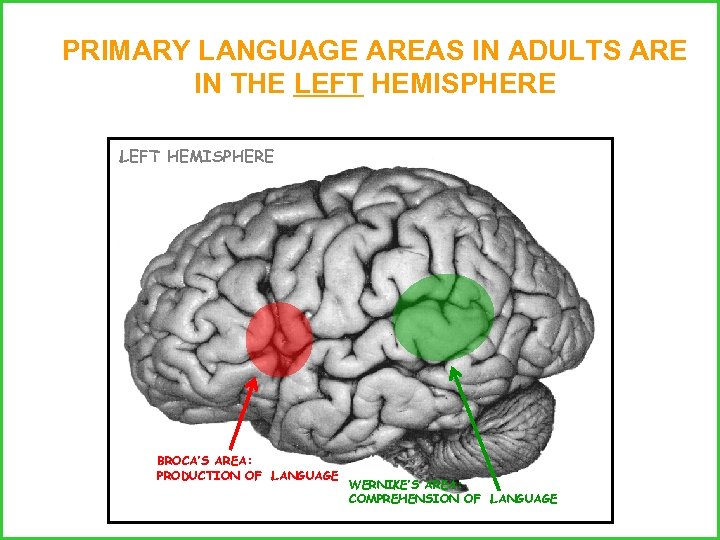PRIMARY LANGUAGE AREAS IN ADULTS ARE IN THE LEFT HEMISPHERE RIGHT HEMISPHERE BROCA’S AREA: