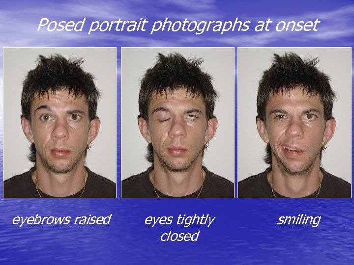 Posed portrait photographs at onset eyebrows raised eyes tightly closed smiling 