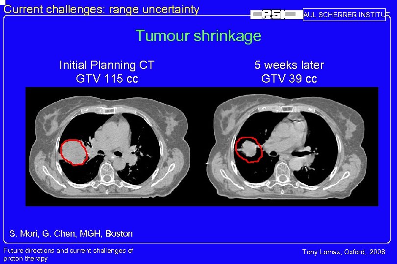 Current challenges: range uncertainty PAUL SCHERRER INSTITUT Tumour shrinkage Initial Planning CT GTV 115