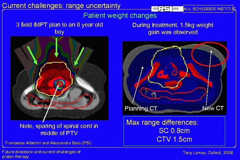 Current challenges: range uncertainty Patient weight changes 3 field IMPT plan to an 8