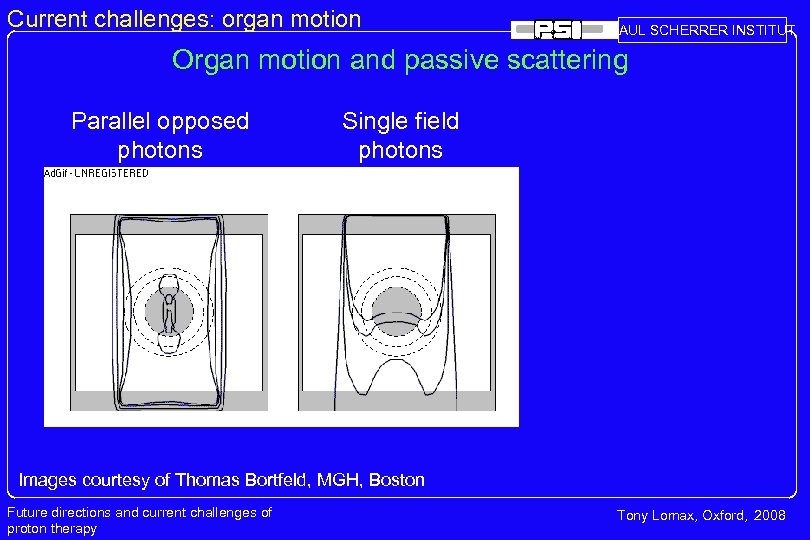 Current challenges: organ motion PAUL SCHERRER INSTITUT Organ motion and passive scattering Parallel opposed
