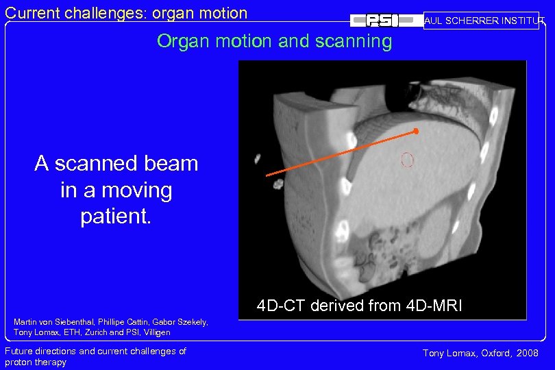 Current challenges: organ motion PAUL SCHERRER INSTITUT Organ motion and scanning A scanned beam
