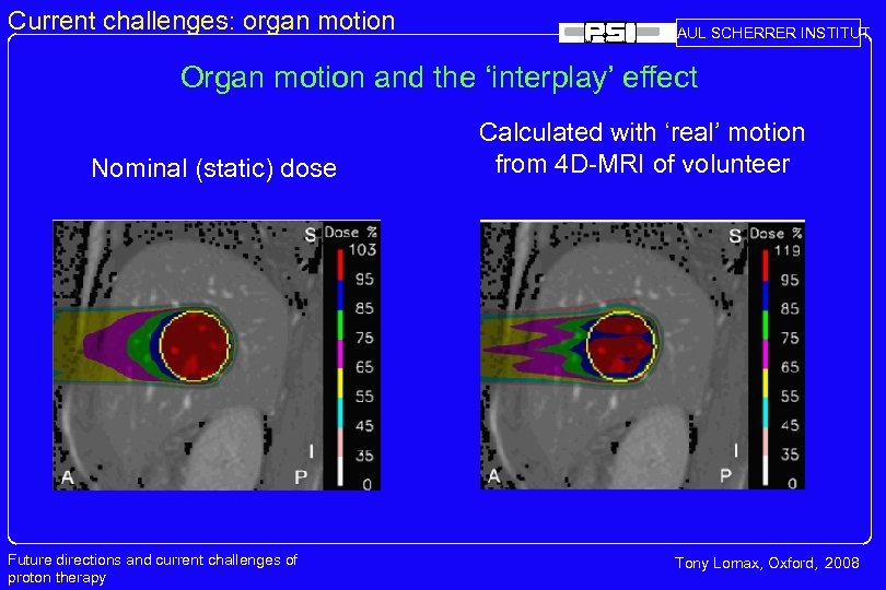 Current challenges: organ motion PAUL SCHERRER INSTITUT Organ motion and the ‘interplay’ effect Nominal