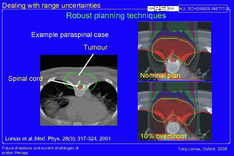 Dealing with range uncertainties Robust planning techniques PAUL SCHERRER INSTITUT Example paraspinal case Tumour