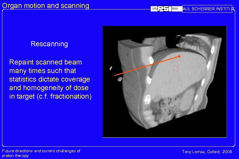 Organ motion and scanning PAUL SCHERRER INSTITUT Rescanning Repaint scanned beam many times such