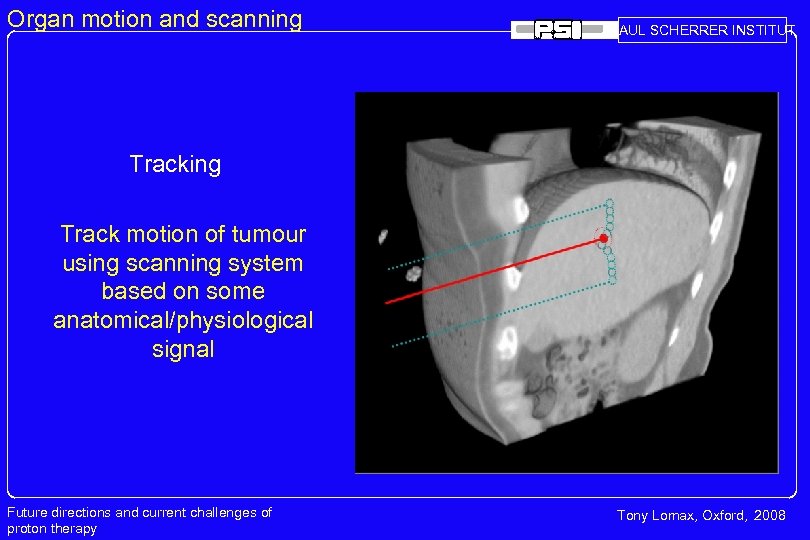 Organ motion and scanning PAUL SCHERRER INSTITUT Tracking Track motion of tumour using scanning