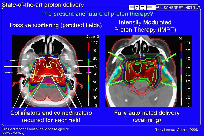 State-of-the-art proton delivery PAUL SCHERRER INSTITUT The present and future of proton therapy? Intensity