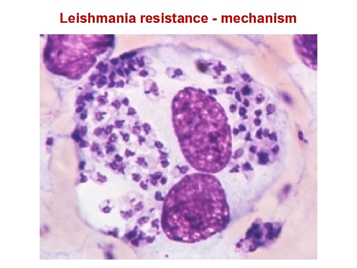 Leishmania resistance - mechanism Th 1 IFN- Inflammatory Th 1 T cell Macrophage and