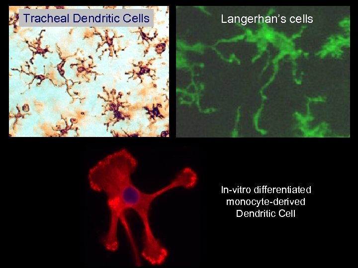 Tracheal Dendritic Cells Langerhan’s cells In-vitro differentiated monocyte-derived Dendritic Cell 