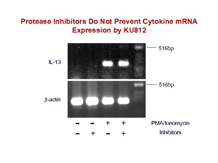 Protease Inhibitors Do Not Prevent Cytokine m. RNA Expression by KU 812 516 bp