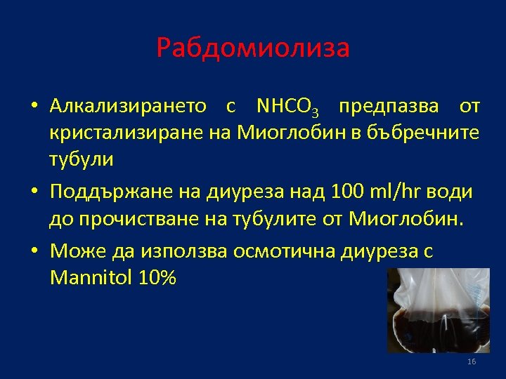 Рабдомиолиза • Алкализирането с NHCO 3 предпазва от кристализиране на Миоглобин в бъбречните тубули