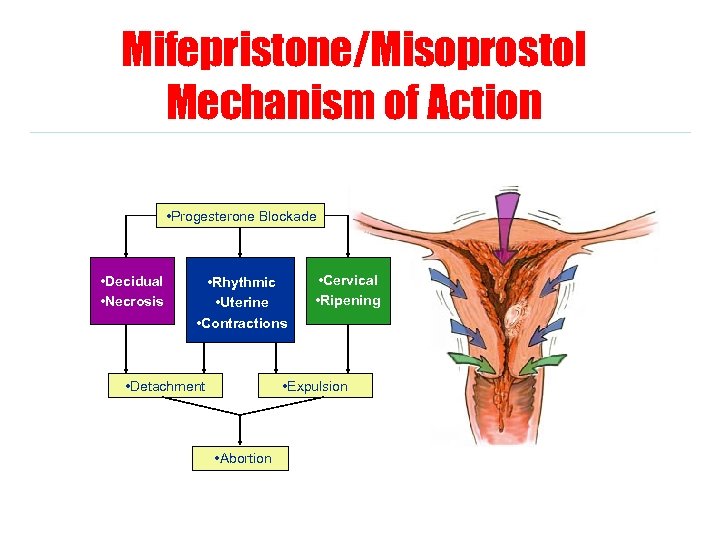 Mifepristone/Misoprostol Mechanism of Action • Progesterone Blockade • Decidual • Necrosis • Rhythmic •