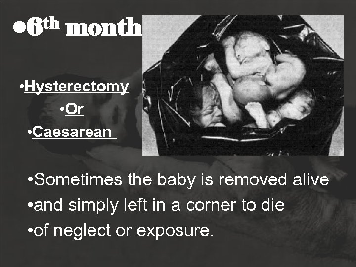  • 6 th month • Hysterectomy • Or • Caesarean • Sometimes the