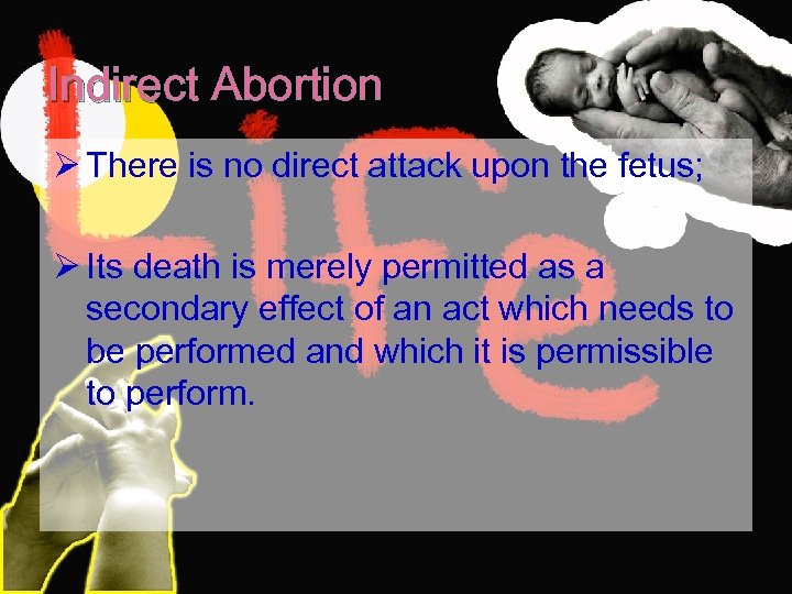 Indirect Abortion Ø There is no direct attack upon the fetus; Ø Its death