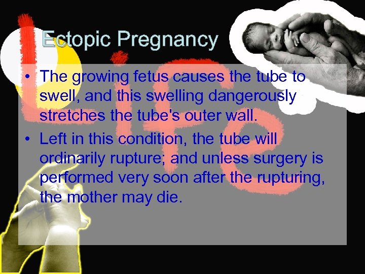 Ectopic Pregnancy • The growing fetus causes the tube to swell, and this swelling