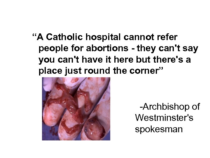 “A Catholic hospital cannot refer people for abortions - they can't say you can't