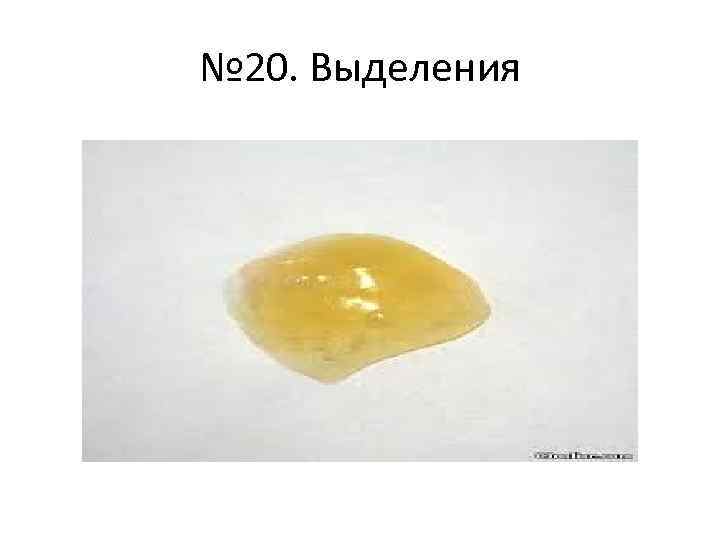 № 20. Выделения 