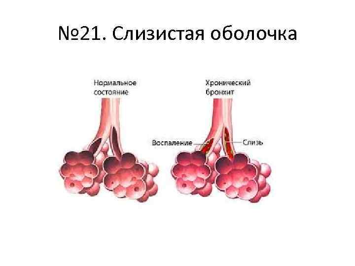 № 21. Слизистая оболочка 