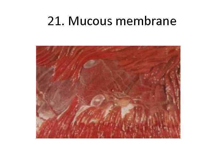 21. Mucous membrane 