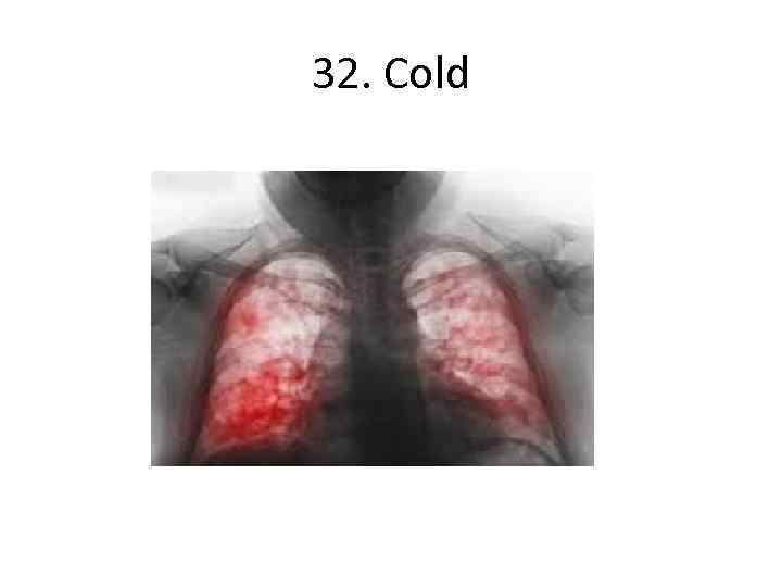 32. Cold 