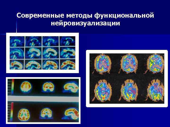 Современные методы функциональной нейровизуализации 