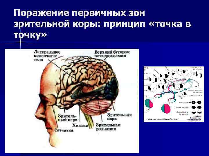 Какой цифрой на рисунке обозначена кость защищающая слуховую зону коры головного мозга