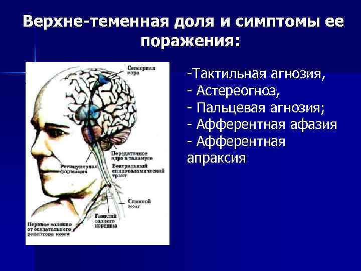 Верхне-теменная доля и симптомы ее поражения: -Тактильная агнозия, - Астереогноз, - Пальцевая агнозия; -