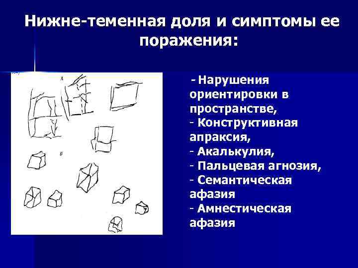 Нижне-теменная доля и симптомы ее поражения: - Нарушения ориентировки в пространстве, - Конструктивная апраксия,