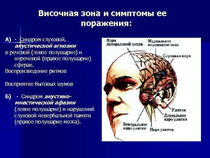 Височная зона и симптомы ее поражения: А) - Синдром слуховой, акустической агнозии в речевой