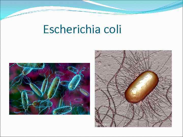 Escherichia coli 