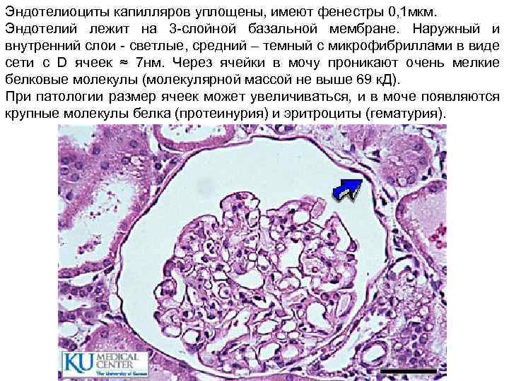 Эндотелиоциты капилляров уплощены, имеют фенестры 0, 1 мкм. Эндотелий лежит на 3 -слойной базальной