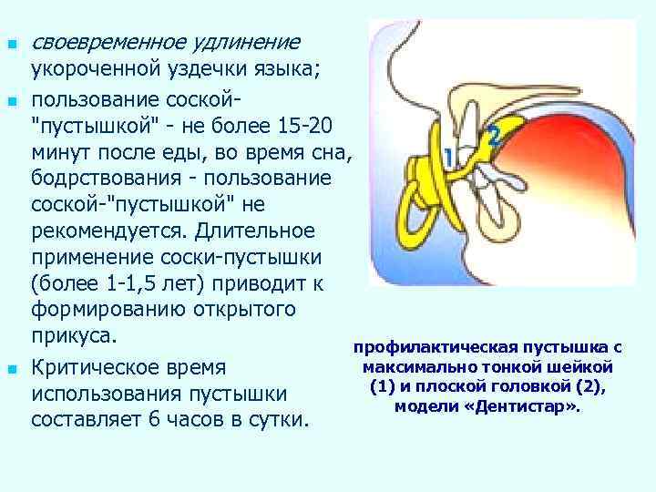 n n n своевременное удлинение укороченной уздечки языка; пользование соской"пустышкой" - не более 15